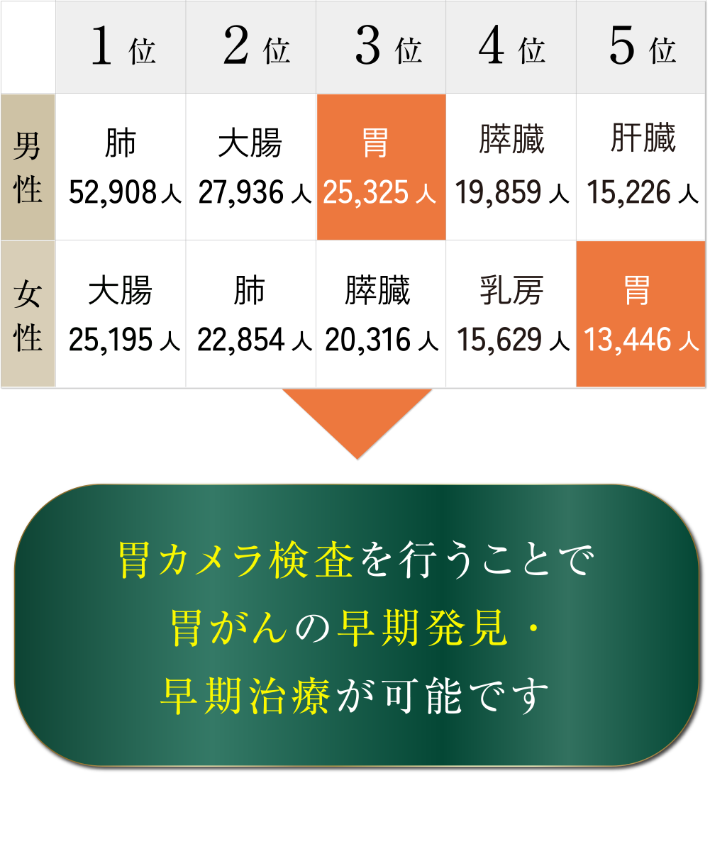 2023年 部位別がん死亡数の表／胃カメラ検査を行うことで胃がんの早期発見・早期治療が可能です